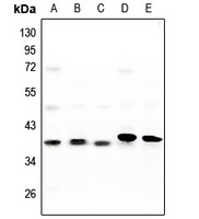 CK1 alpha Rabbit Polyclonal Antibody