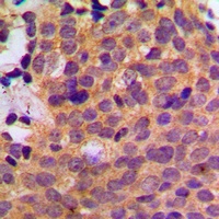 CK1 alpha Rabbit Polyclonal Antibody