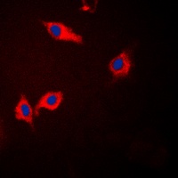 CK1 alpha Rabbit Polyclonal Antibody