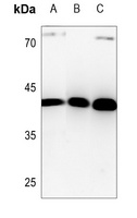 HuB Rabbit Polyclonal Antibody