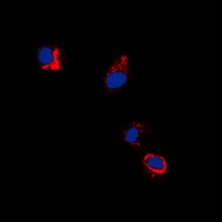 EPHB1/2 (Phospho-Y594/604) Antibody