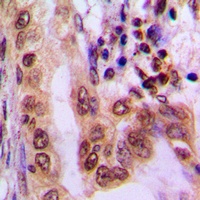 AMPK alpha 1/2 (Phospho-T183/172) Antibody