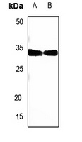 SIAH1/2 Rabbit Polyclonal Antibody