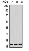 Histone H3 (Phospho-T11) Antibody