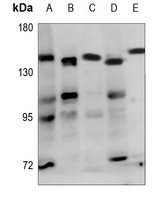 ADAMTS18 Rabbit Polyclonal Antibody