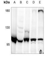 Apolipoprotein B Receptor Rabbit Polyclonal Antibody