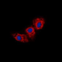 Cadherin 23 Rabbit Polyclonal Antibody