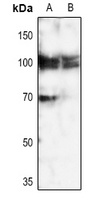 Calpain 3 Rabbit Polyclonal Antibody