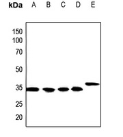 Calponin 1 Rabbit Polyclonal Antibody