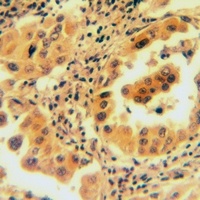 Calponin 1 Rabbit Polyclonal Antibody