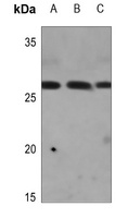CAPNS2 Rabbit Polyclonal Antibody
