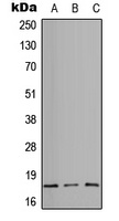 CD49e HC Rabbit Polyclonal Antibody
