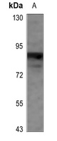 CD66c Rabbit Polyclonal Antibody