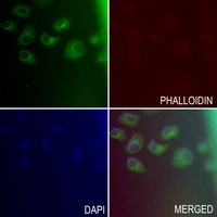 CD66c Rabbit Polyclonal Antibody