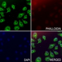 Collagen 1 alpha 1 Rabbit Polyclonal Antibody