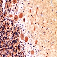 Collagen 5 alpha 2 Antibody
