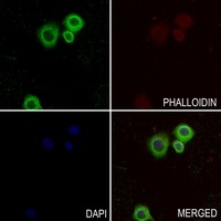 Collagen 5 alpha 2 Antibody