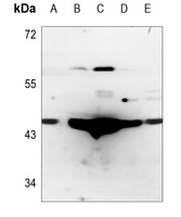 CTH Rabbit Polyclonal Antibody