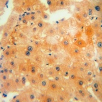 CTH Rabbit Polyclonal Antibody