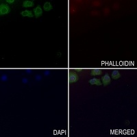CYFIP1 Antibody [KO/KD Validated]