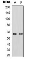Cytochrome P450 11B2 Rabbit Polyclonal Antibody