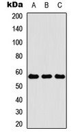 Cytokeratin 4 Rabbit Polyclonal Antibody
