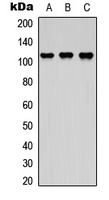 DDEF2 Rabbit Polyclonal Antibody