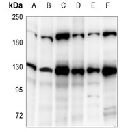 DNMT3A Rabbit Polyclonal Antibody
