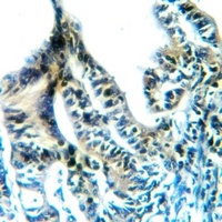 DNMT3A Rabbit Polyclonal Antibody