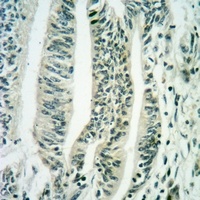 EIF2S2 (Phospho-S67) Rabbit Polyclonal Antibody
