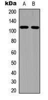 EPHA1 (Phospho-Y605) Rabbit Polyclonal Antibody