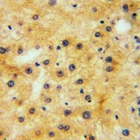 EPHA1 (Phospho-Y605) Rabbit Polyclonal Antibody