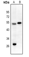 EPX HC Antibody