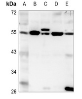 EYA1 Rabbit Polyclonal Antibody