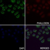 Factor IX LC Rabbit Polyclonal Antibody