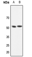 GABRR1 Rabbit Polyclonal Antibody