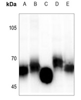 GGT5 HC Antibody