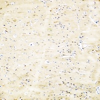 GH1 Rabbit Polyclonal Antibody