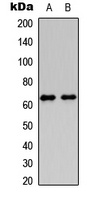 HABP2 HC Rabbit Polyclonal Antibody