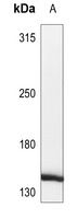 HCAP (Phospho-S1083) Rabbit Polyclonal Antibody