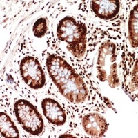 HLA-DQB1 Rabbit Polyclonal Antibody