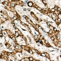IDH2 Rabbit Polyclonal Antibody