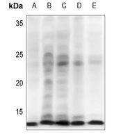IGF1 Antibody