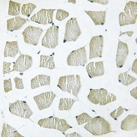 ITIH4 70k Rabbit Polyclonal Antibody