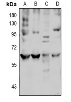 LAT2 Rabbit Polyclonal Antibody