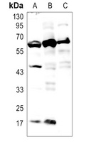 M-CSF Antibody