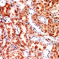 M-CSF Antibody