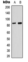 Myeloperoxidase LC Rabbit Polyclonal Antibody