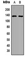 PPP4R1 Rabbit Polyclonal Antibody