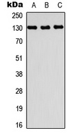 PRDM10 Rabbit Polyclonal Antibody